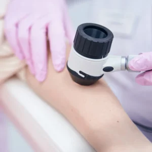 Dermatoscopie